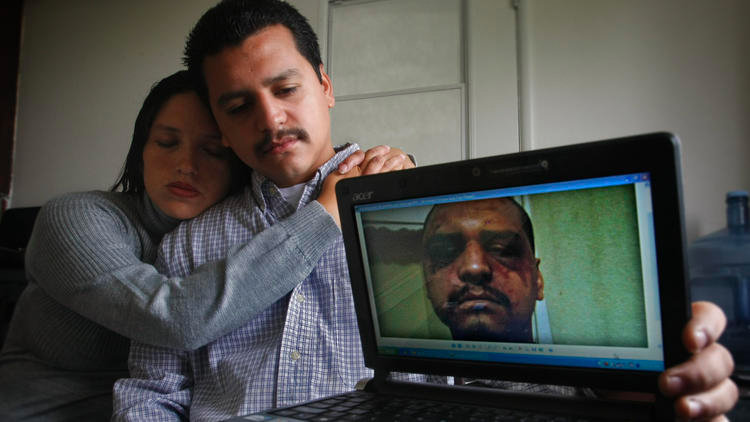 Gabriel Carrillo and Grace Martinez show a photo she took of Carrillo a few days after he was beaten by Los Angeles County sheriff's deputies at the Men's Central Jail. (Credit: Don Bartlett /Los Angeles Times)