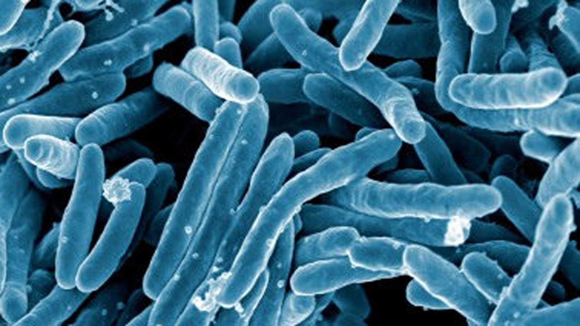 A scanning electron micrograph of Mycobacterium tuberculosis bacteria, which cause tuberculosis, is pictured. (Credit: NIAID / Flickr via Creative Commons)