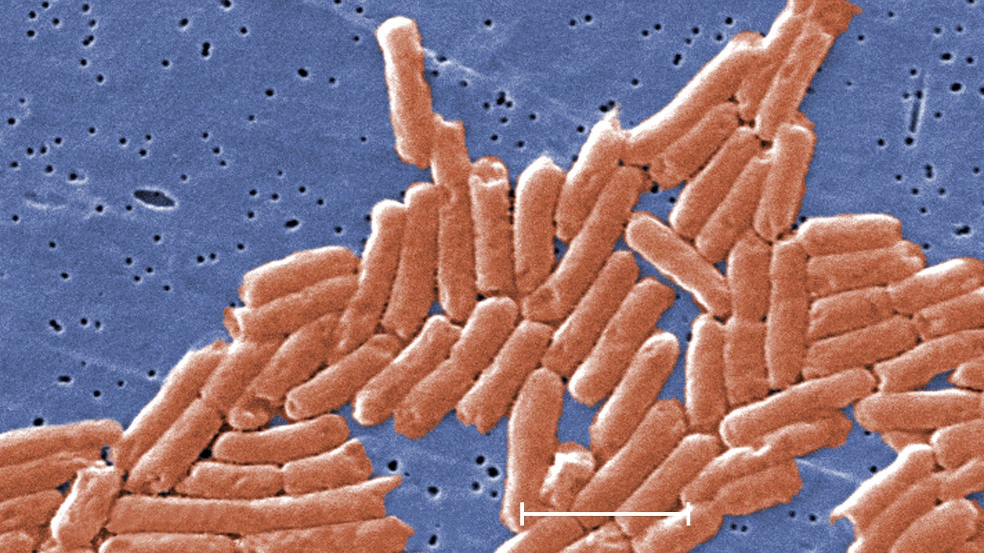 An image of salmonella distributed by the CDC.