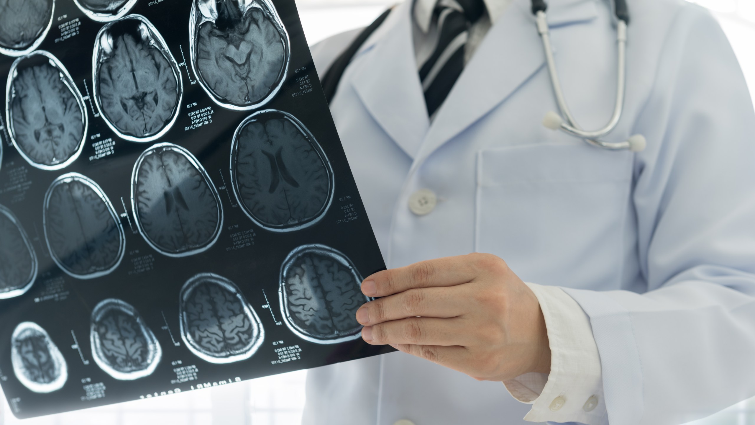 A doctor examines a brain scan in this file photo. (Credit: iStock / Getty Images Plus)