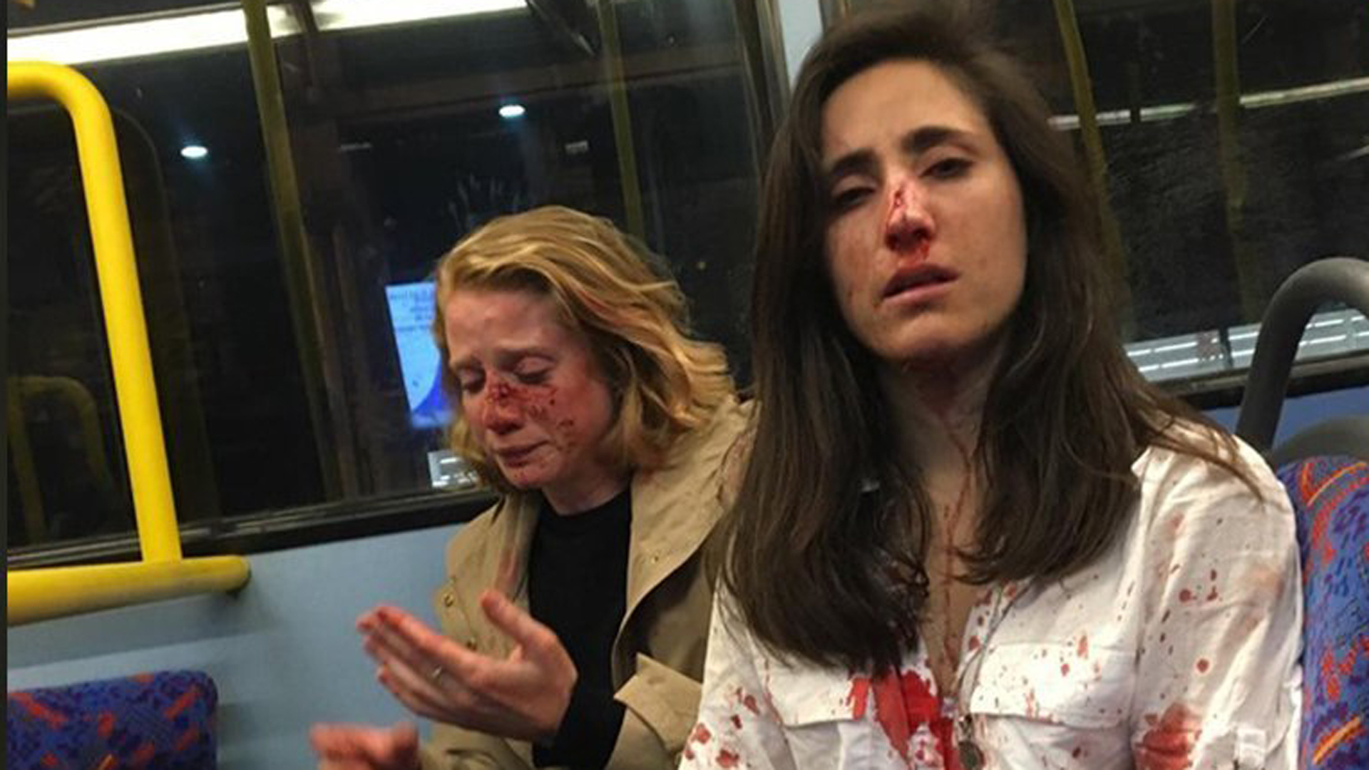 Melania Geymonat, pictured on the right, posted this photo of herself and her girlfriend to Facebook on June 5, 2019 after they were attacked on a London bus. (Credit: CNN)