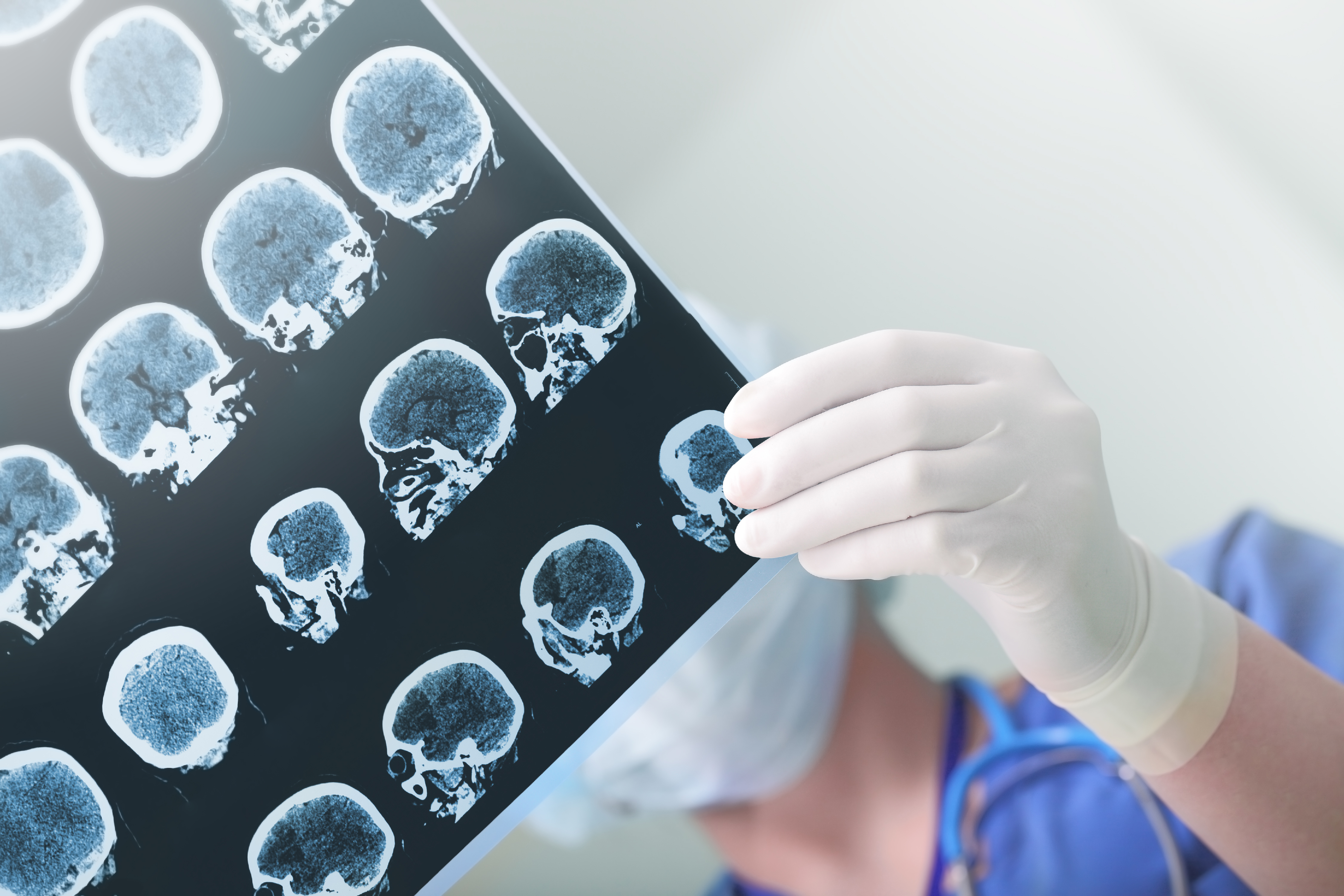 A medical expert studies a brain scan in this file photo. (Credit: iStock / Getty Images)