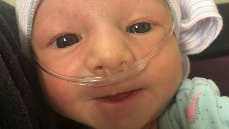 Baby Lily is seen in a photo posted to a GoFundMe page.