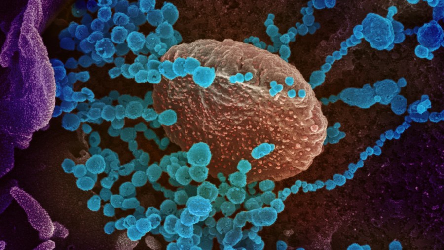 This scanning electron microscope image shows coronavirus emerging from the surface of cells cultured in a lab. (Credit: National Institute of Allergy and Infectious Diseases)