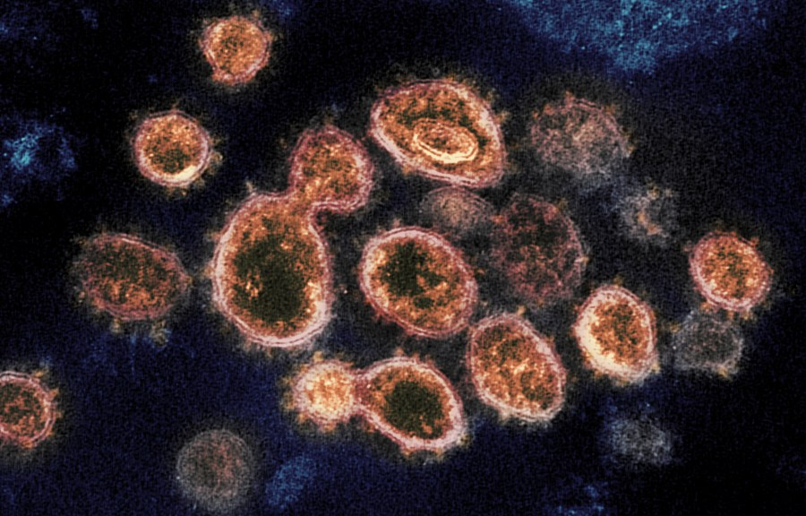 This transmission electron microscope image shows the virus that causes COVID-19, isolated from a patient in the U.S. (NIAID-RML)