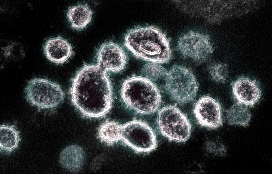 This transmission electron microscope image shows the virus that causes COVID-19, isolated from a patient in the U.S. (NIAID-RML)