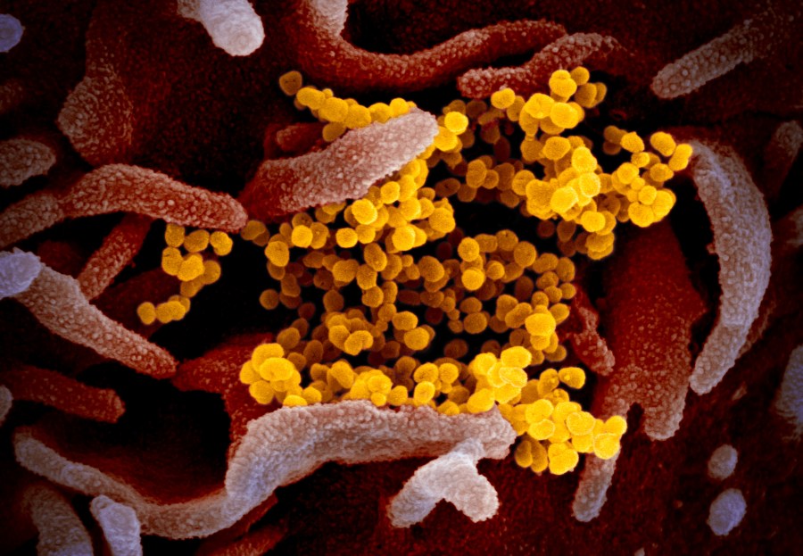 This scanning electron microscope image shows SARS-CoV-2 (yellow)—also known as 2019-nCoV, the virus that causes COVID-19 isolated from a patient in the U.S., emerging from the surface of cells (pink) cultured in the lab. (NIAID-RML)