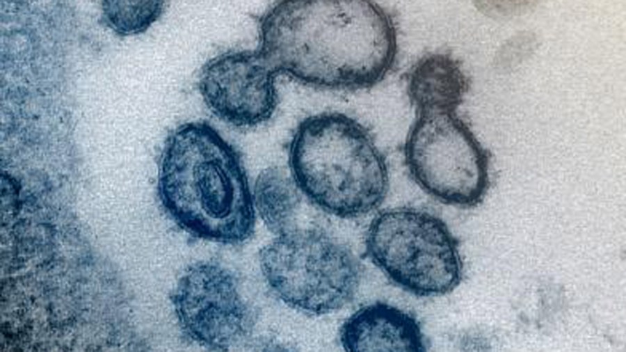 A microscope image shows 2019-nCoV, the virus that causes COVID-19, isolated from a patient in the U.S. (National Institute of Allergy and Infectious Diseases)