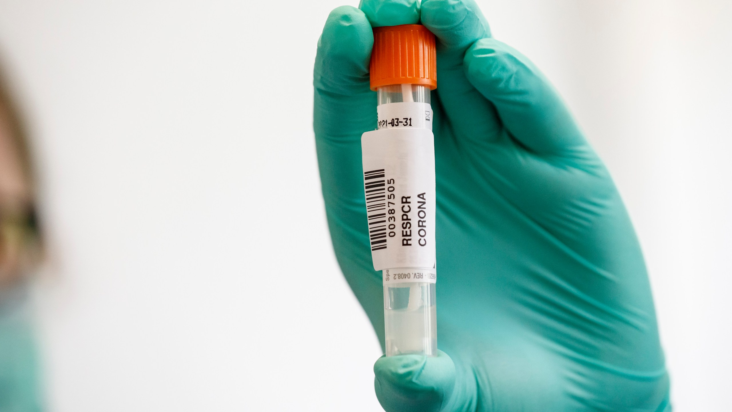 An employee wearing a protective mask and gloves shows a throat swab sample for Covid-19 testing at the Labor Dr. Heidrich & Kollegen MVZ GmbH medical lab on April 16, 2020, in Hamburg, Germany. (Morris MacMatzen/Getty Images)