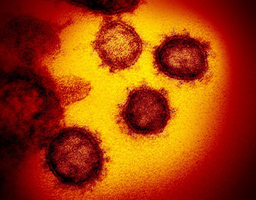 The novel coronavirus is seen under an electron microscope. (National Institute of Allergy and Infectious Diseases)