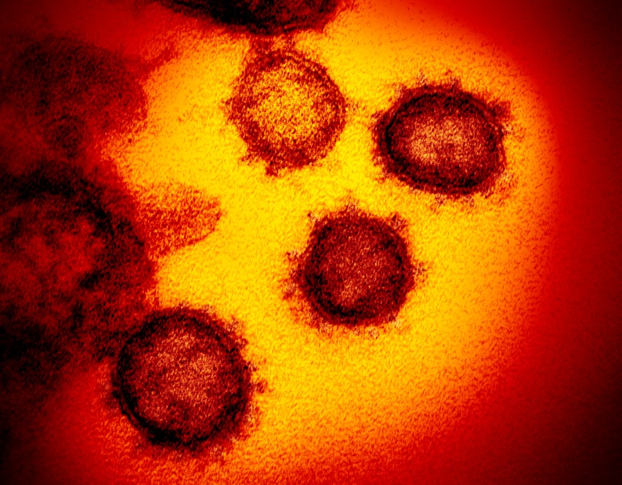 This undated electron microscope image made available by the U.S. National Institutes of Health in February 2020 shows the Novel Coronavirus SARS-CoV-2. Also known as 2019-nCoV, the virus causes COVID-19. The sample was isolated from a patient in the U.S. (NIAID-RML via AP)