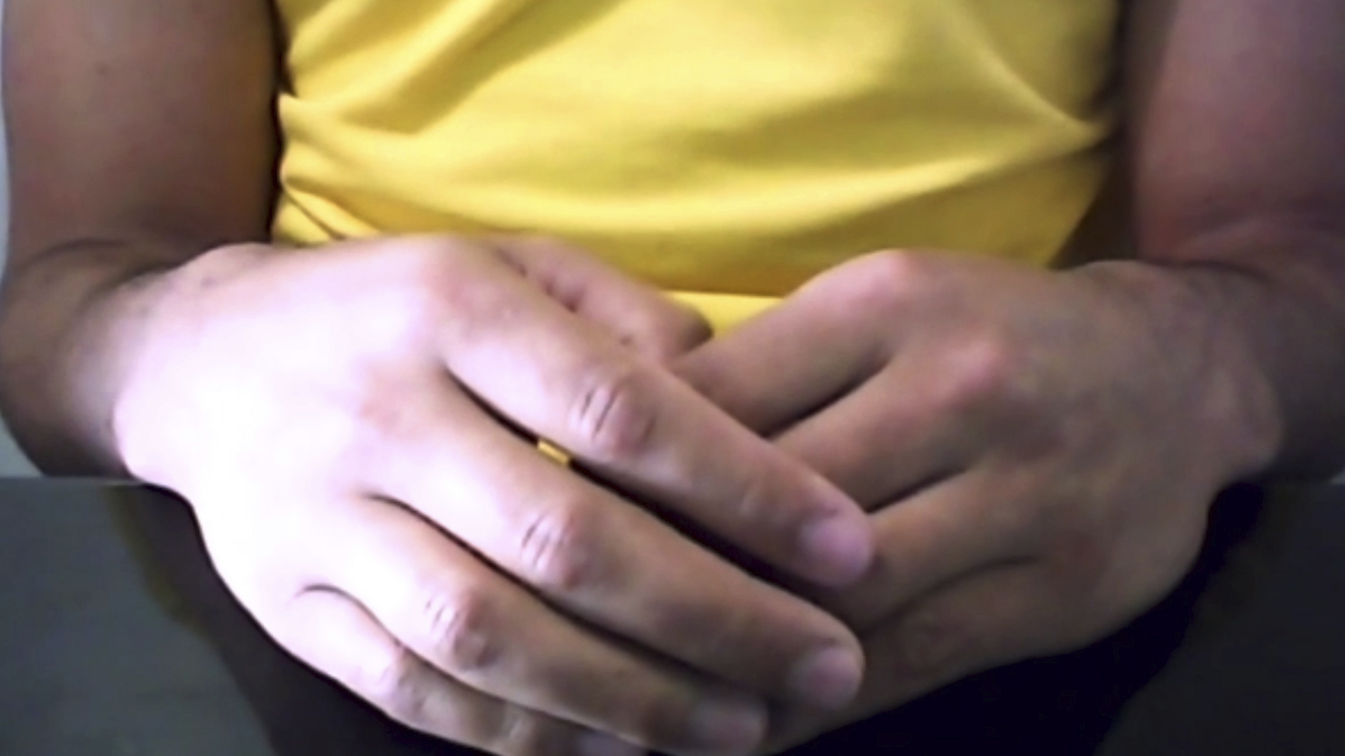 This mage made from video shows the hands of a Brazilian man who was infected with the AIDS virus and has shown no sign of it for more than a year since he stopped HIV medicines after an intense experimental drug therapy aimed at purging hidden, dormant virus from his body, doctors reported Tuesday, July 7, 2020. “I’m very moved because it’s something that millions of people want,” said the 35-year-old man, whose spoke to The Associated Press on condition that his name not be published. (Federica Narancio/Zoom via AP)