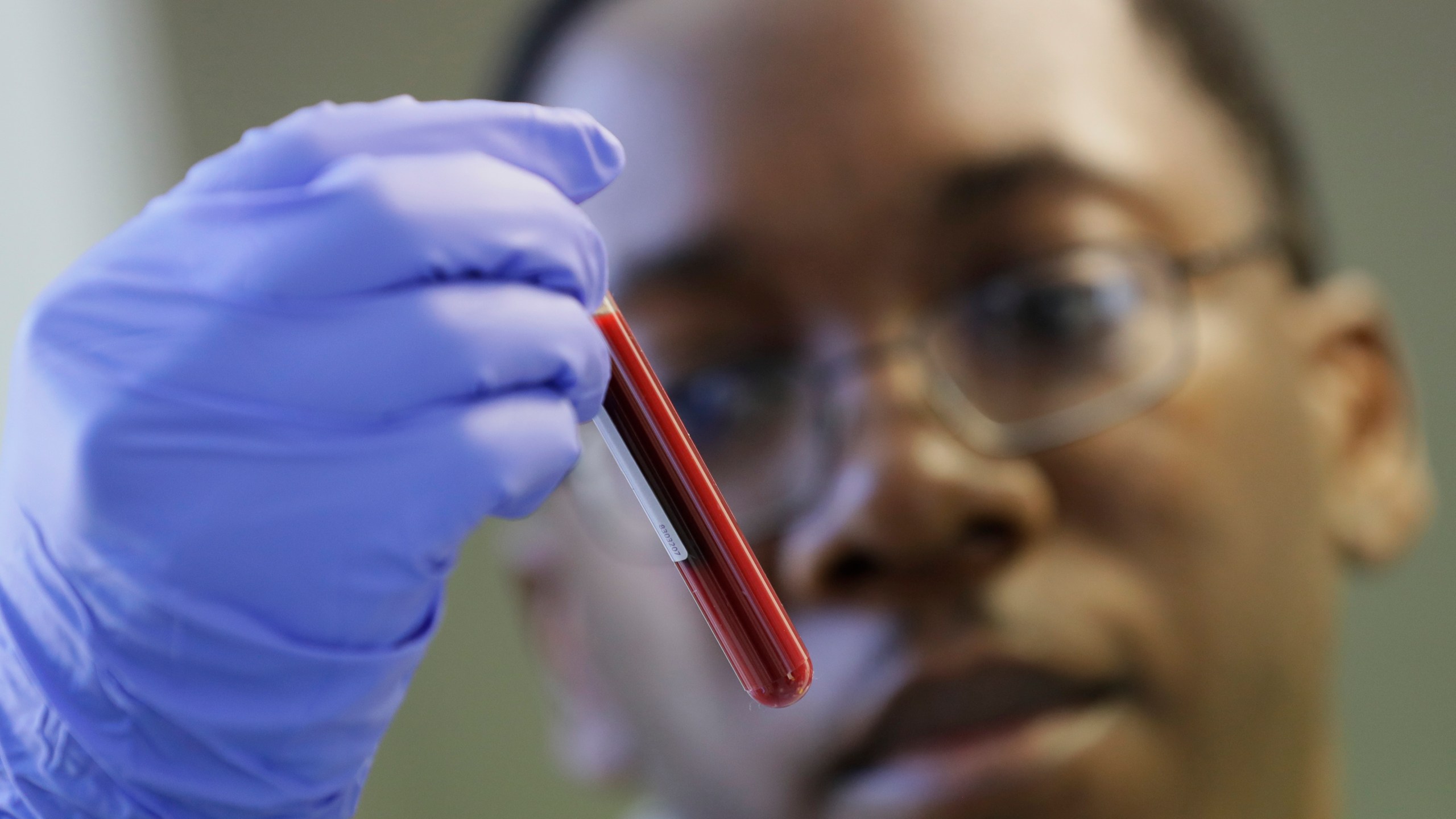 Leon McFarlane, a research technician, handles a blood sample from a volunteer in the laboratory at Imperial College in London, Thursday, July 30, 2020. Imperial College is working on the development of a COVID-19 vaccine. Scientists at Imperial College London say they are immunizing hundreds of people with an experimental coronavirus vaccine in an early trial after seeing no worrying safety problems in those vaccinated so far. (AP Photo/Kirsty Wigglesworth)