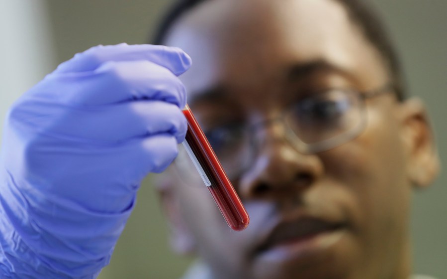 Leon McFarlane, a research technician, handles a blood sample from a volunteer in the laboratory at Imperial College in London, Thursday, July 30, 2020. Imperial College is working on the development of a COVID-19 vaccine. Scientists at Imperial College London say they are immunizing hundreds of people with an experimental coronavirus vaccine in an early trial after seeing no worrying safety problems in those vaccinated so far. (AP Photo/Kirsty Wigglesworth)