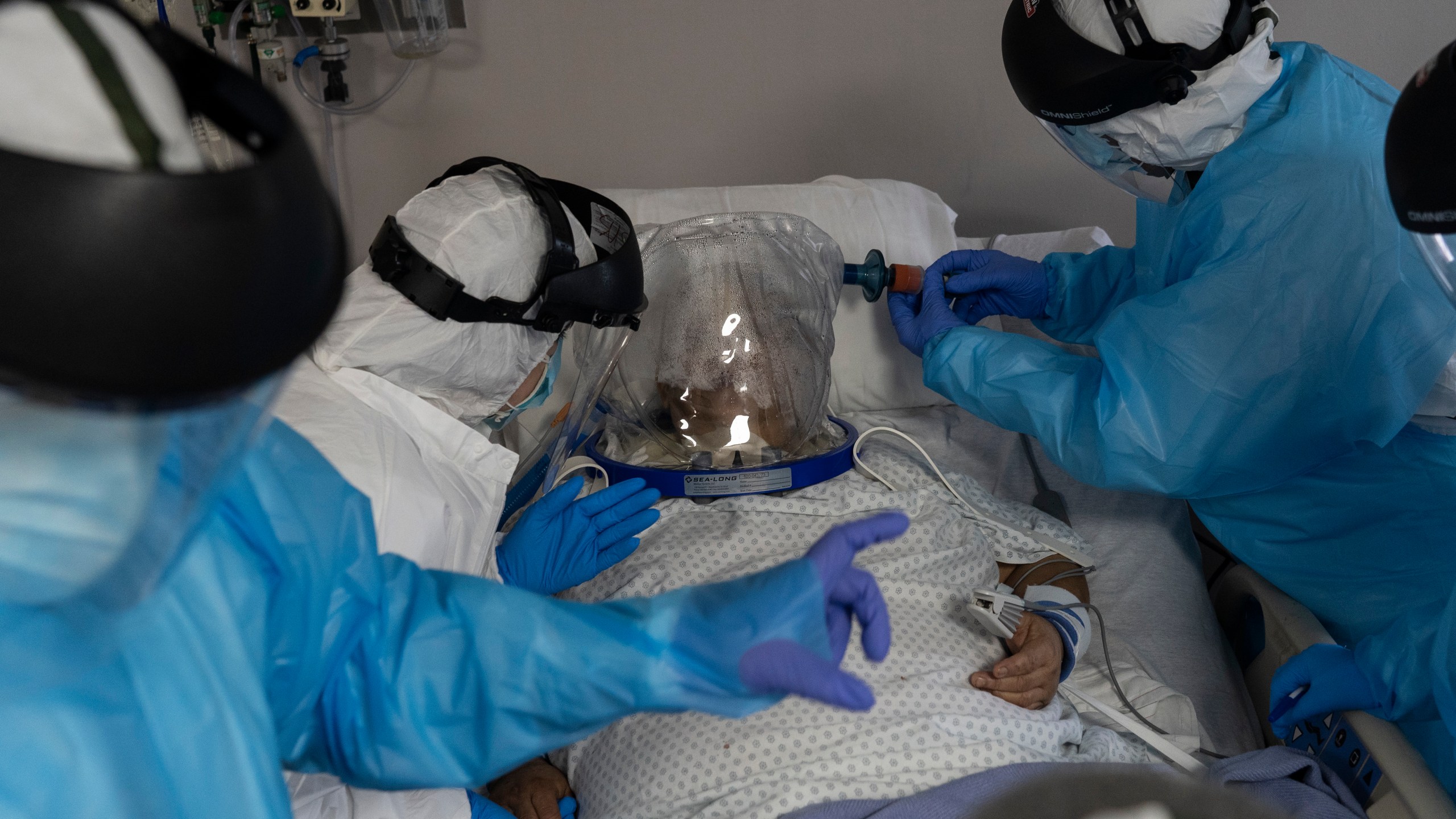 Medical workers treat a patient who is wearing a helmet-based ventilator in the COVID-19 intensive care unit at the United Memorial Medical Center on July 28, 2020 in Houston, Texas. COVID-19 cases and hospitalizations have spiked since Texas reopened, pushing intensive care units to full capacity and sparking concerns about a surge in fatalities as the virus spreads. (Go Nakamura/Getty Images)