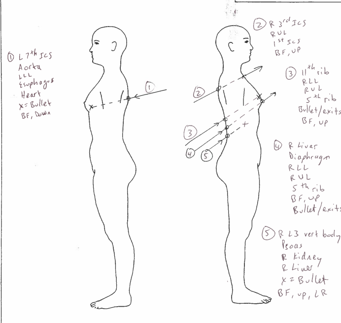 Diagrams showing gunshot wounds suffered by Andres Guardado. (Los Angeles County Department of Medical Examiner-Coroner)