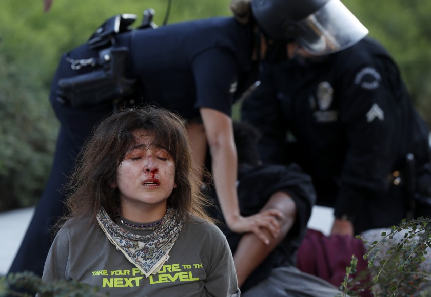 A woman’s face is bloodied as LAPD officers take down protesters who were part of a group that shattered glass windows at the U.S. Courthouse in downtown L.A. on July 25, 2020. (Luis Sinco/Los Angeles Times)