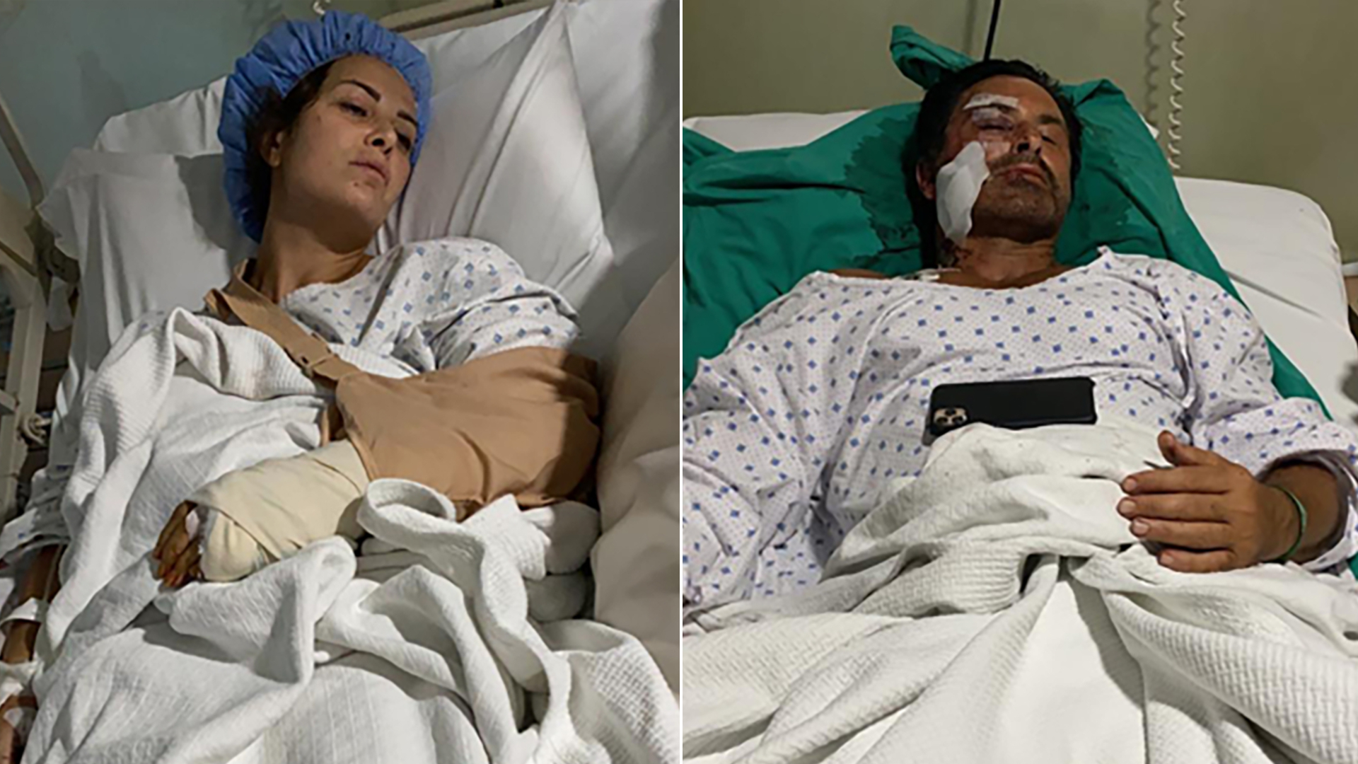 Lina Alameh, and Imad Khalil are seen in their hospital beds after undergoing surgery for injuries sustained in the Beirut explosion in undated photos the couple provided to CNN.