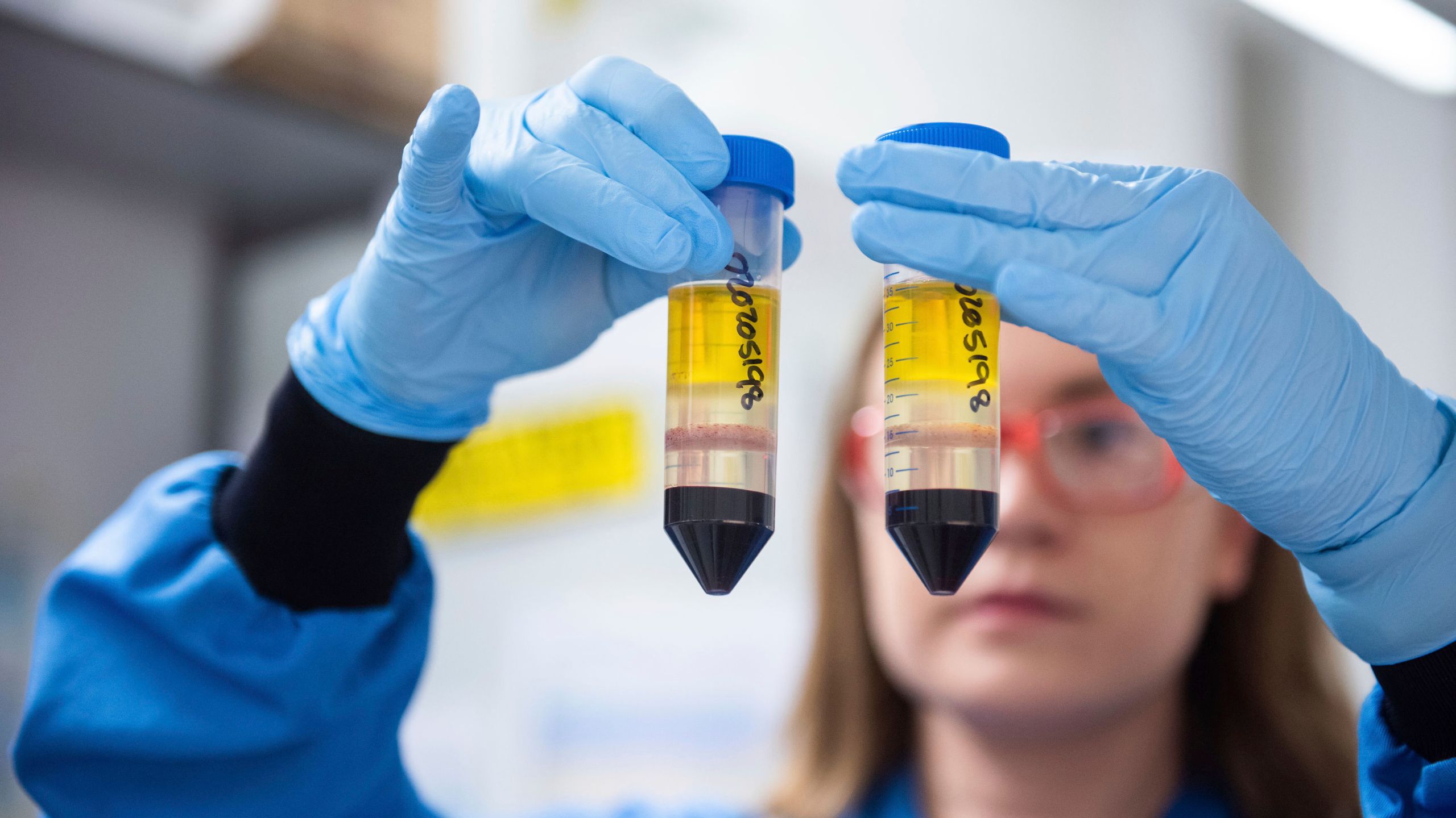 In this undated file photo issued by the University of Oxford on Nov. 23, 2020, a researcher in a laboratory at the Jenner Institute in Oxford, England, works on the coronavirus vaccine developed by AstraZeneca and Oxford University. (University of Oxford / John Cairns via Associated Press)