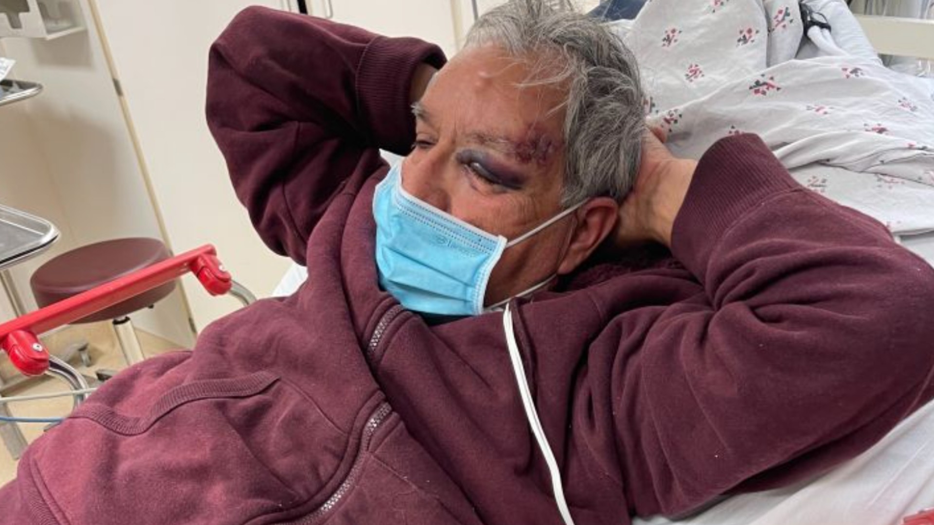 Family members shared a photo on a GoFundMe page of a man who was beaten outside a Baldwin Park grocery store on April 6, 2021.