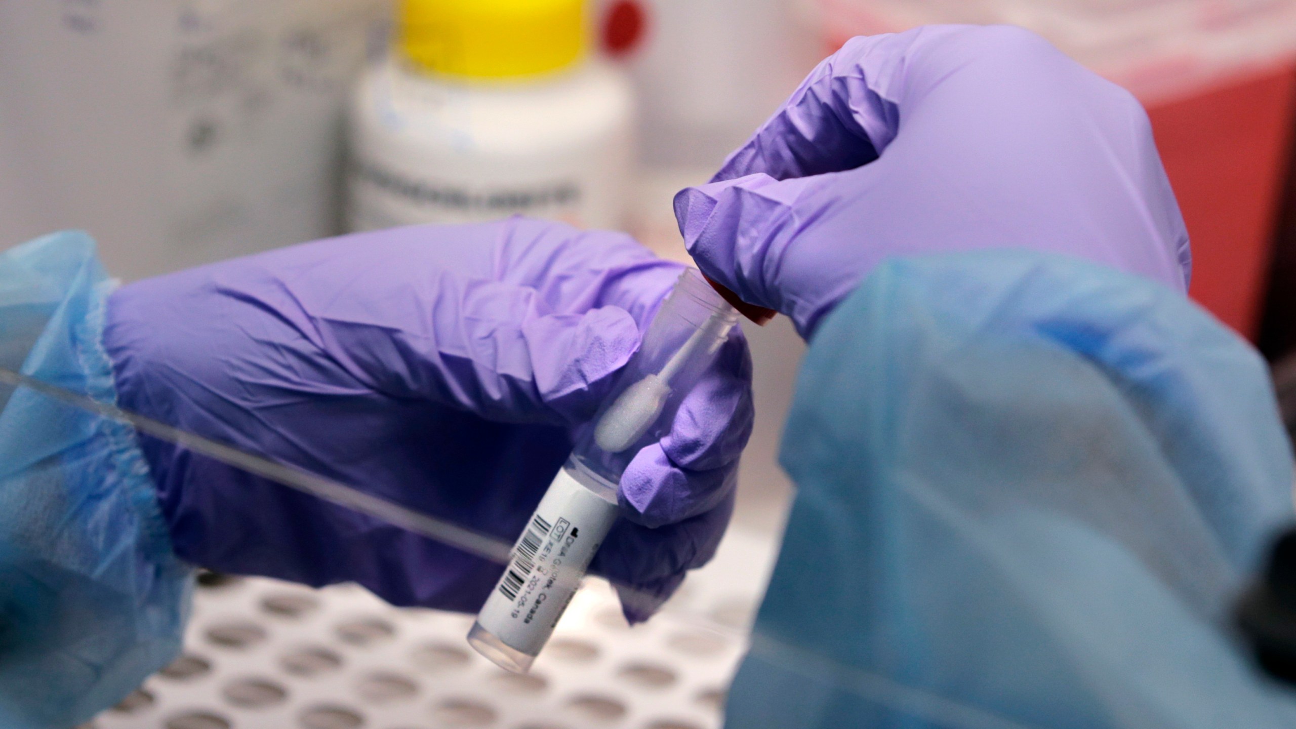 James Robson, a biomedical engineering graduate student, holds a swab and specimen vial in the new COVID-19, on-campus testing lab, Thursday, July 23, 2020, at Boston University in Boston. The United States has improved its surveillance system for tracking new coronavirus variants such as omicron, boosting its capacity by tens of thousands of samples since early 2021. (AP Photo/Charles Krupa, File)