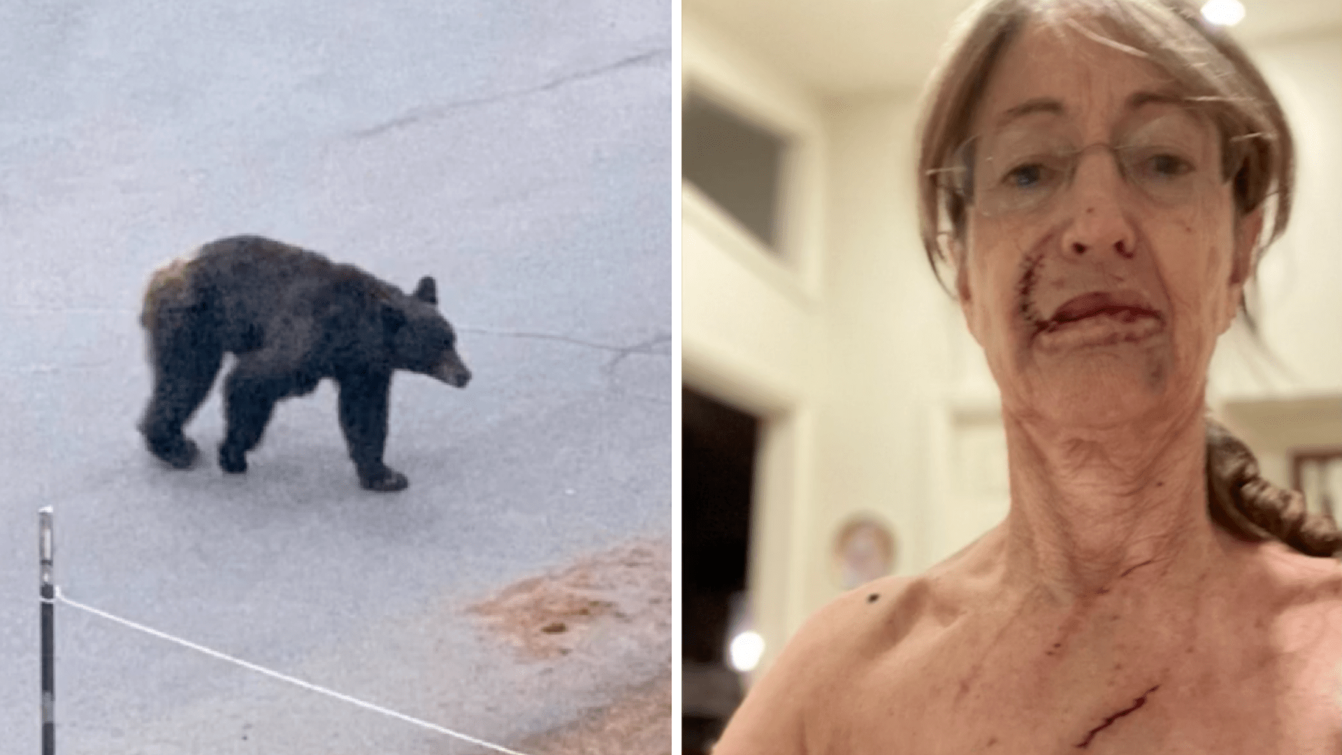 Laurel-Rose Von Hoffmann-Curzi is seen after a bear attack. On the left is a photo of a bear she previously snapped at her cabin. (KRON)