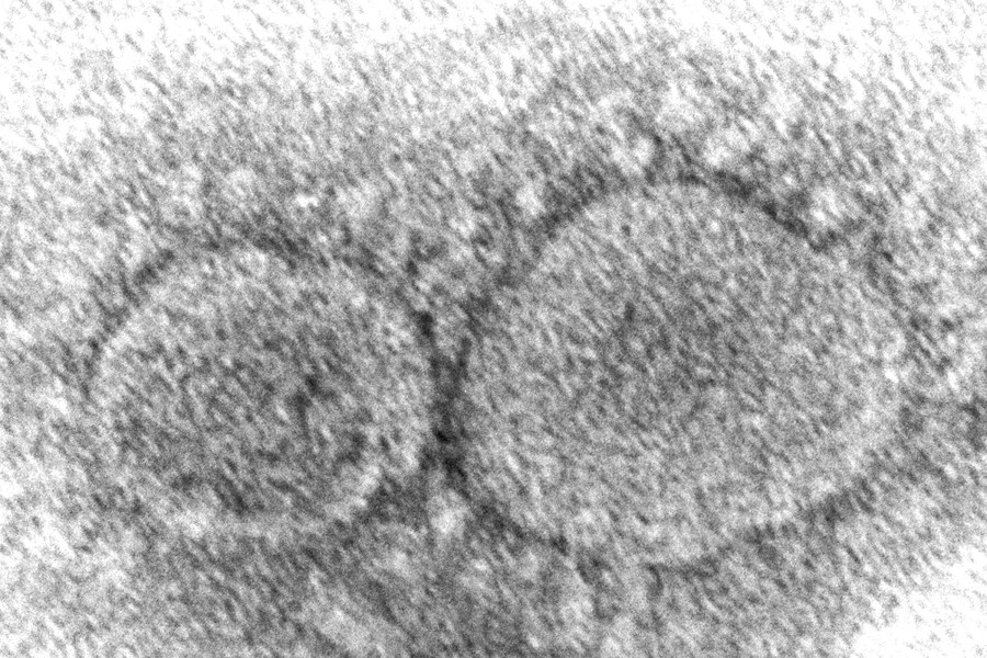 This 2020 electron microscope image made available by the Centers for Disease Control and Prevention shows SARS-CoV-2 virus particles which cause COVID-19. The World Health Organization has appointed an independent scientific panel to advise on whether vaccine shots need reformulating because of omicron or any other mutant. (Hannah A. Bullock, Azaibi Tamin/CDC via AP, File)