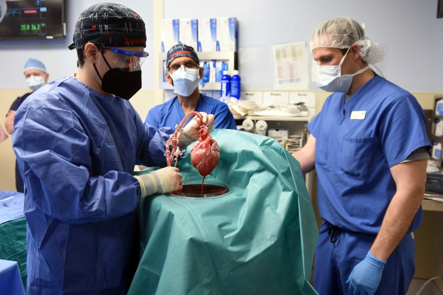 In this photo provided by the University of Maryland School of Medicine, members of the surgical team show the pig heart for transplant into patient David Bennett in Baltimore on Jan. 7, 2022. On Monday, Jan. 10, 2022, the hospital said that he's doing well three days after the highly experimental surgery. (Mark Teske/University of Maryland School of Medicine via AP)