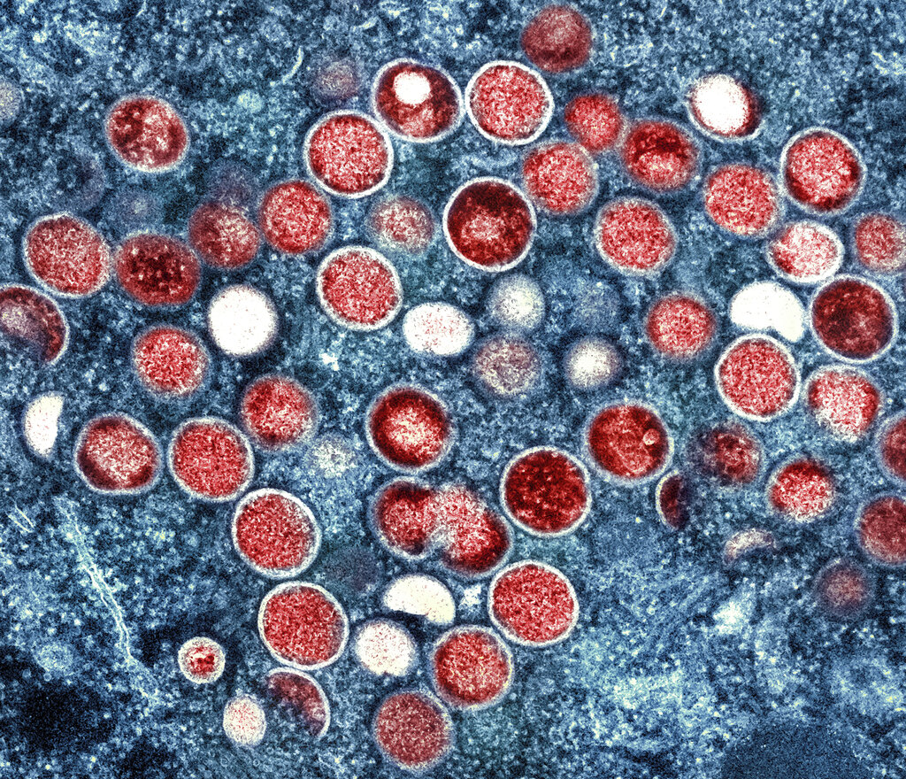 This image provided by the National Institute of Allergy and Infectious Diseases (NIAID) shows a colorized transmission electron micrograph of monkeypox particles (red) found within an infected cell (blue), cultured in the laboratory that was captured and color-enhanced at the NIAID Integrated Research Facility (IRF) in Fort Detrick, Md. (NIAID via AP)