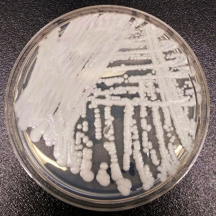 This 2016 photo made available by the Centers for Disease Control and Prevention shows a strain of Candida auris cultured in a petri dish at a CDC laboratory. (Shawn Lockhart/CDC via AP)