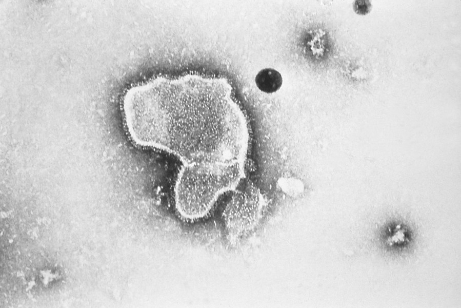 This 1981 photo provided by the Centers for Disease Control and Prevention shows an electron micrograph of Respiratory Syncytial Virus, also known as RSV. (CDC via AP, File)