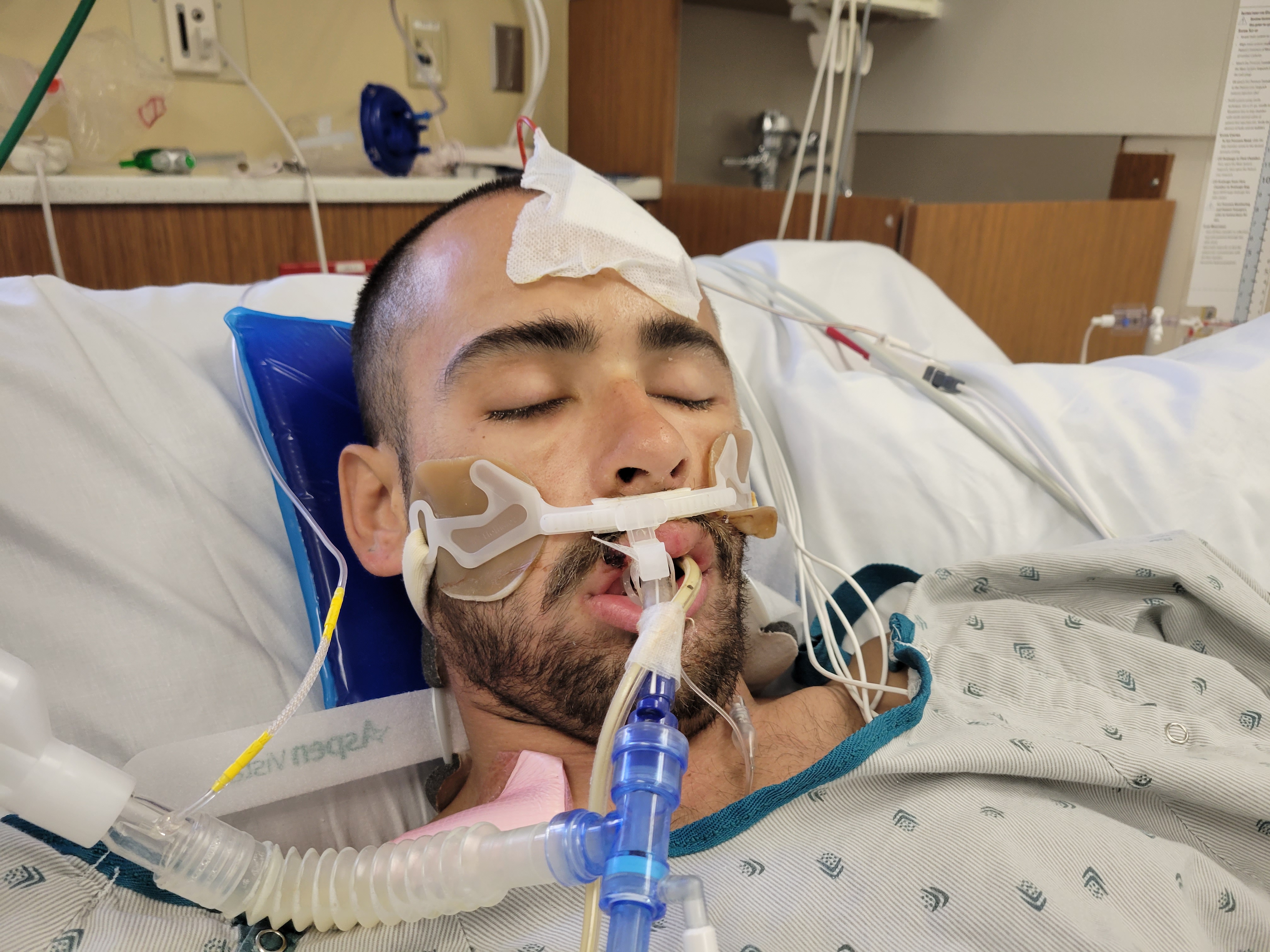 Unidentified male patient at the Pomona Valley Hospital Medical Center.