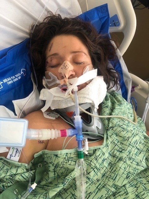 Unidentified female patient who was struck by a car in San Fernando on Jan. 23, 2023. (Providence Holy Cross Medical Center)