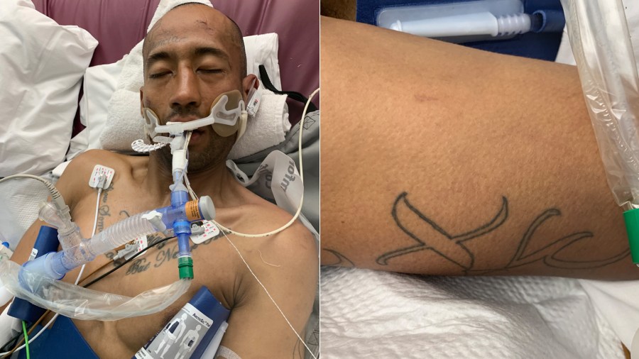 Officials hope to identify a man currently hospitalized at Providence Saint John’s Health Center in Santa Monica. He is seen in images provided by the hospital on Aug. 4, 2023.