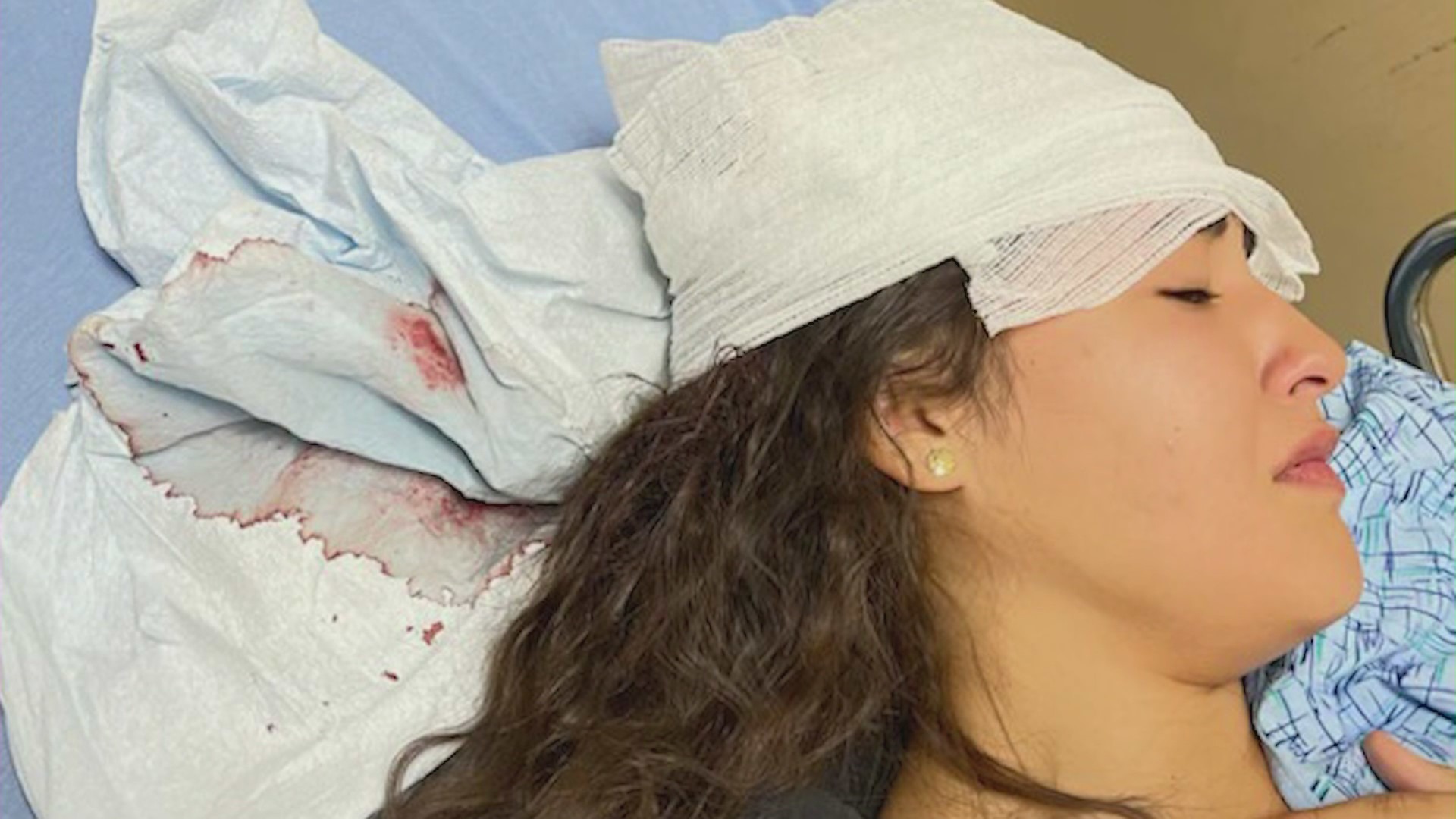 Faith Jeffers, 16, is hospitalized after being thrown to the ground by a sheriff’s deputy during a violent brawl at Victor Valley High School on Sept. 22, 2023. (Priscilla Jeffers)