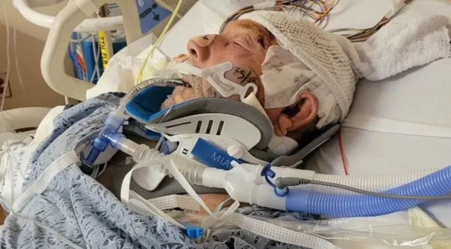 Hit-and-run driver leaves 72-year-old fighting for life