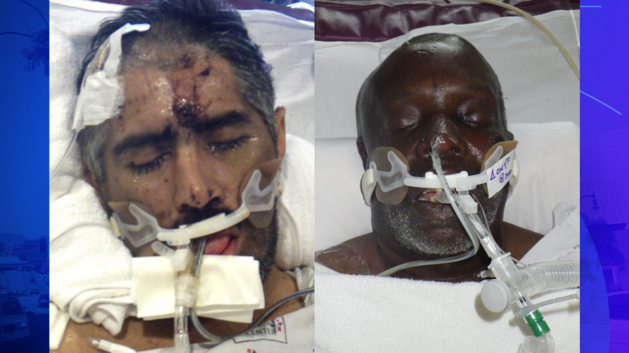 A hospital is asking for help to identify two patients found unconscious in Los Angeles County in February 2024. (Los Angeles General Medical Center) From left: A man in his 40s and a man in his 60s.