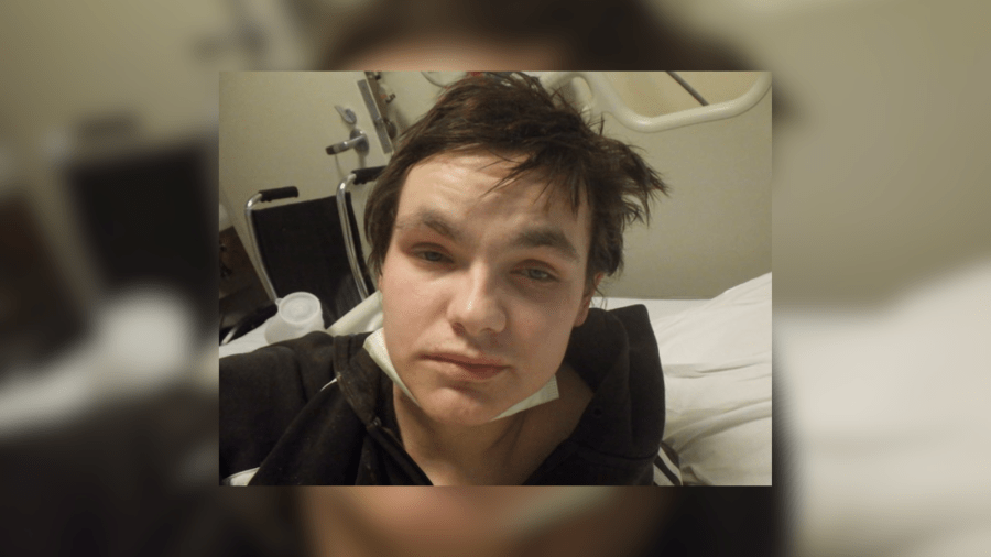 This photo released by Los Angeles General Medical Center on Feb. 1, 2024, shows an unidentified patient who has been hospitalized since December 2023.