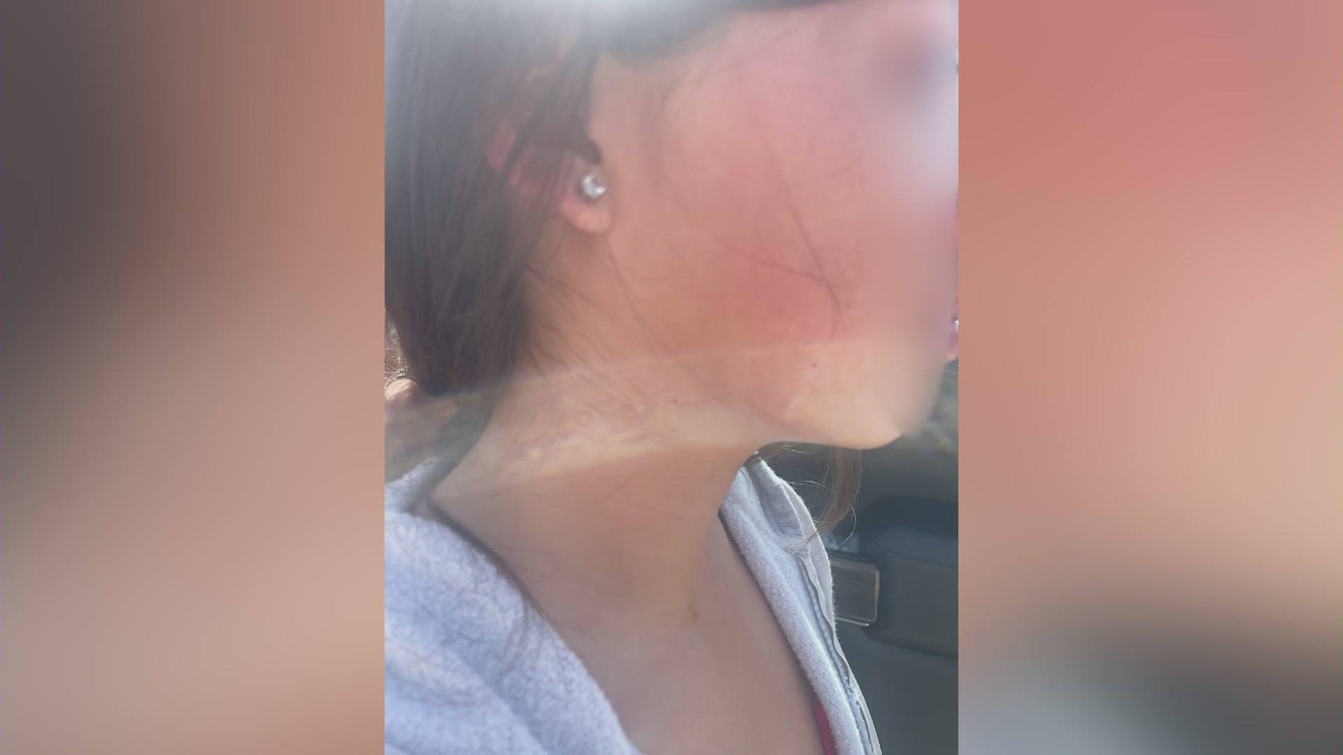 6th grade SoCal girl brutally attacked by classmate