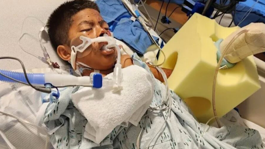 Edther Ocampo, 10, remains hospitalized in the ICU after finding an illegal firework on the ground in San Juan Capistrano on July 5, 2024. (Ocampo Family)