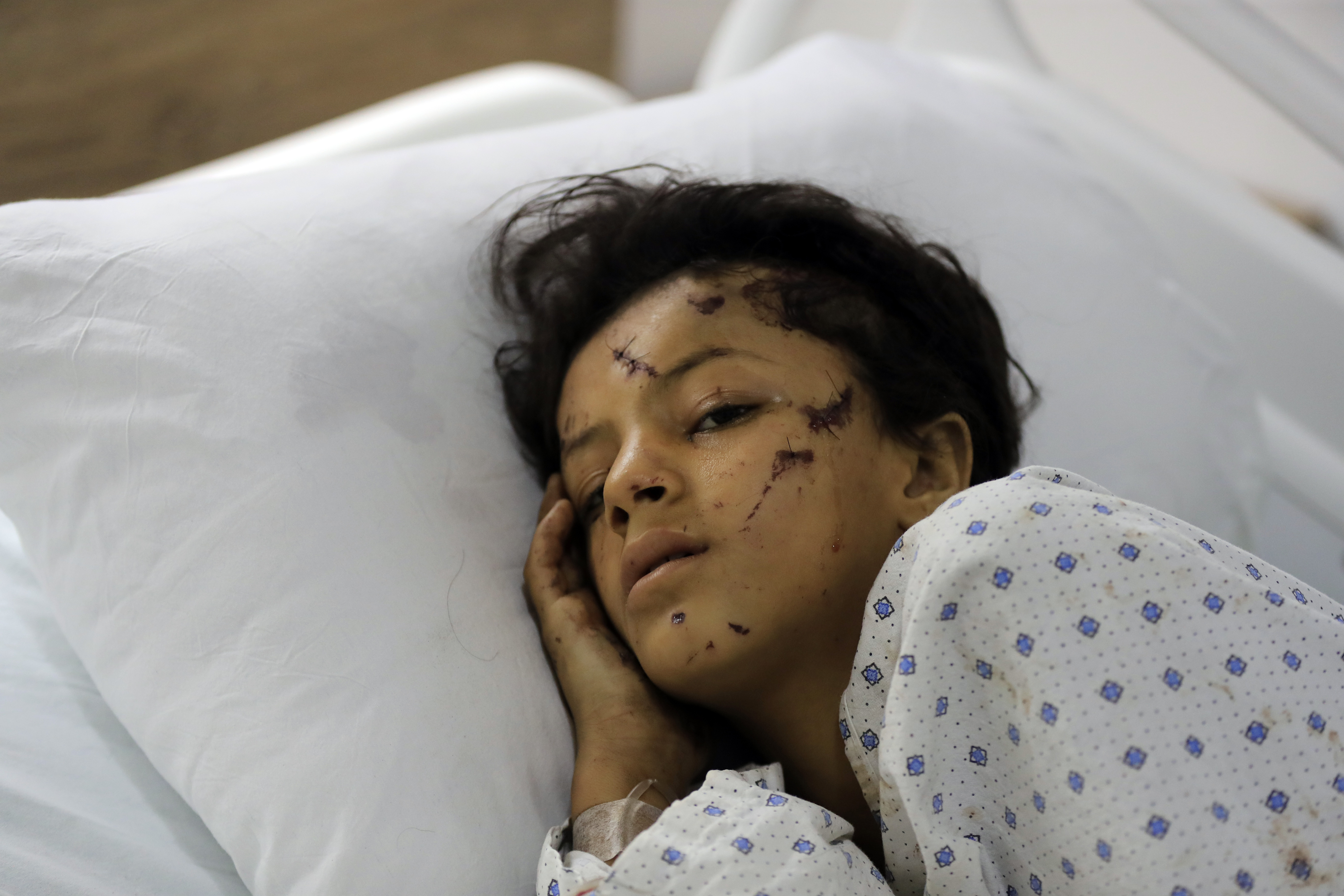 A wounded girl lies in a hospital bed in the southern village of Saksakieh, Lebanon, Tuesday, Sept. 24, 2024. (AP Photo/Mohammed Zaatari)