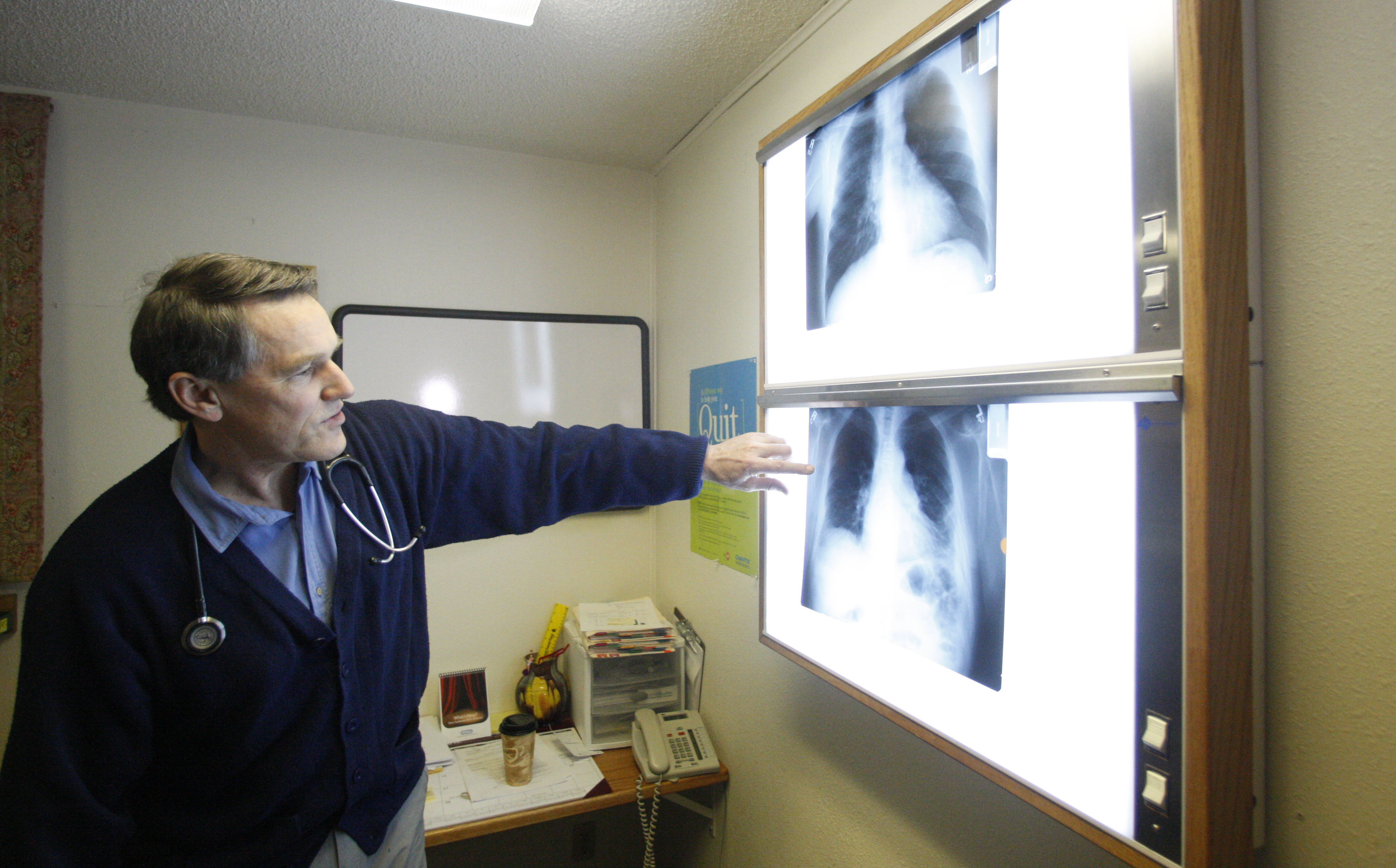 FILE - Dr. Brad Black with the Center for Asbestos Related Disease health clinic is shown looking at X-rays, Feb. 18, 2010, in Libby, Mont. (AP Photo/Rick Bowmer, File)