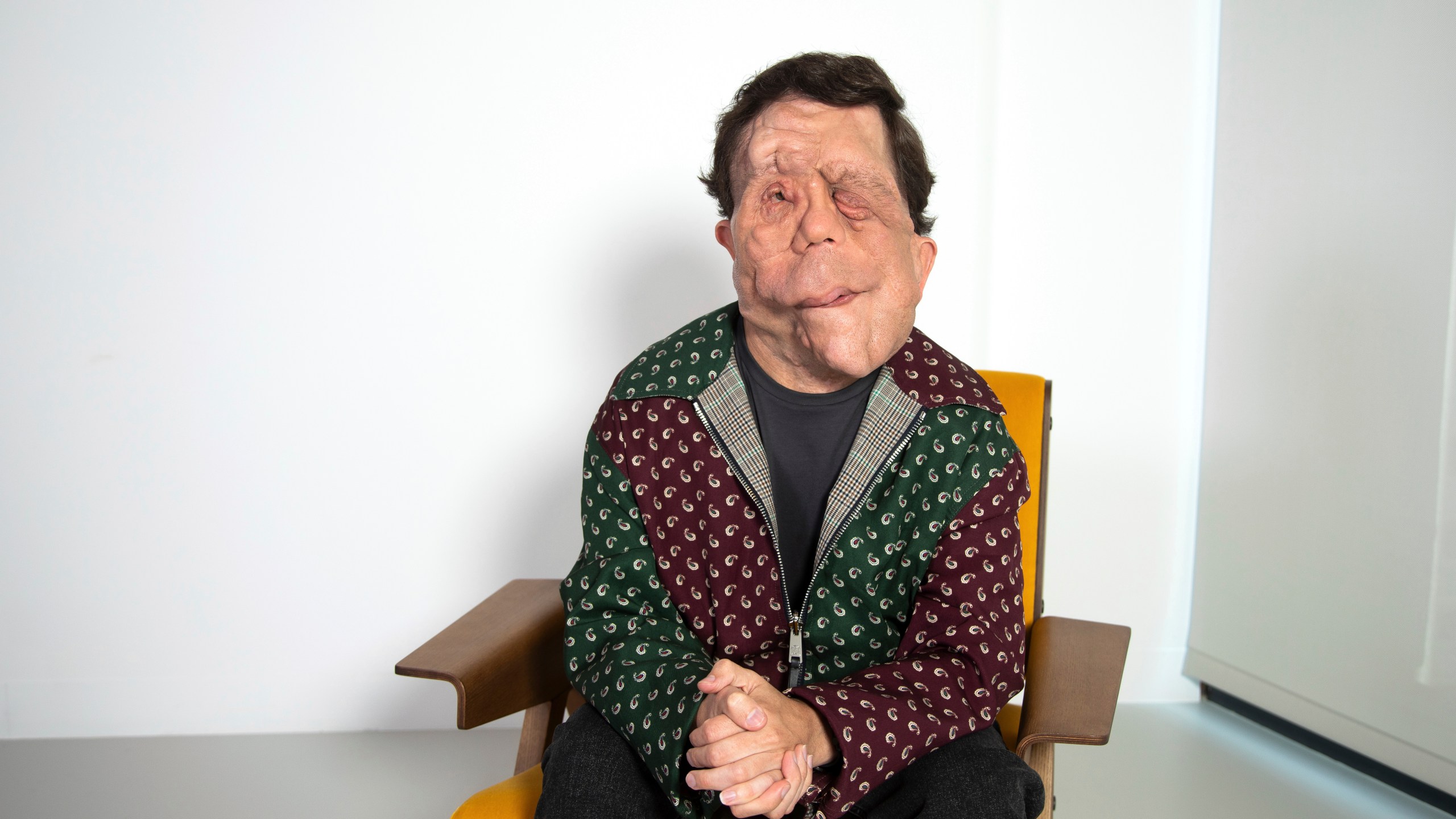 Adam Pearson poses for a portrait on Tuesday, Sept. 17, 2024, in New York. (Photo by Andy Kropa/Invision/AP)