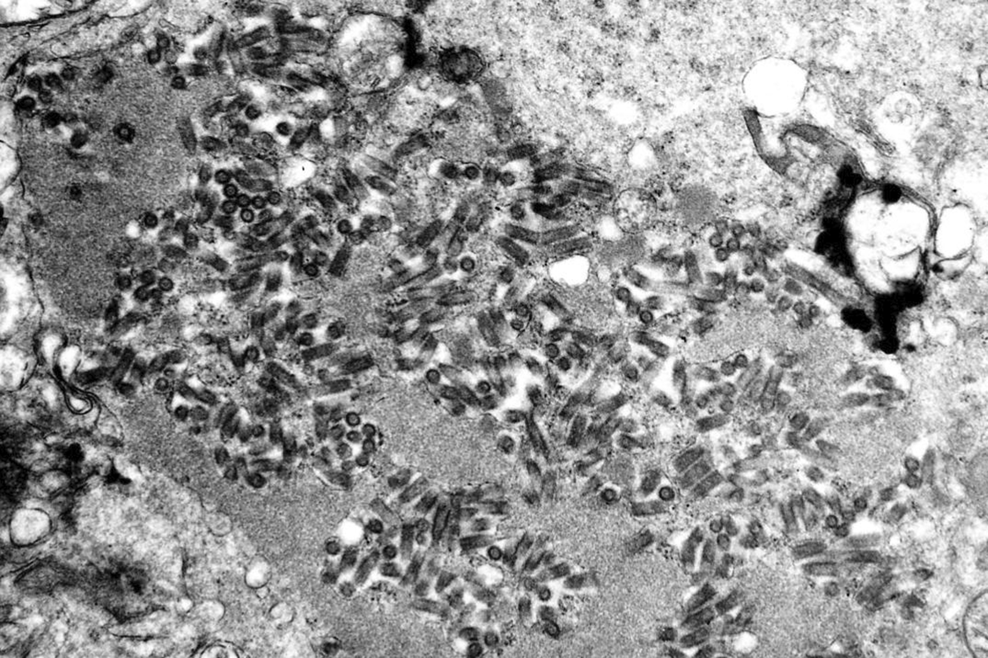 FILE - This undated electron microscope image made available by the Centers for Disease Control and Prevention shows rabies virions, dark and bullet-shaped, within an infected tissue sample. (F. A. Murphy/CDC via AP, File)