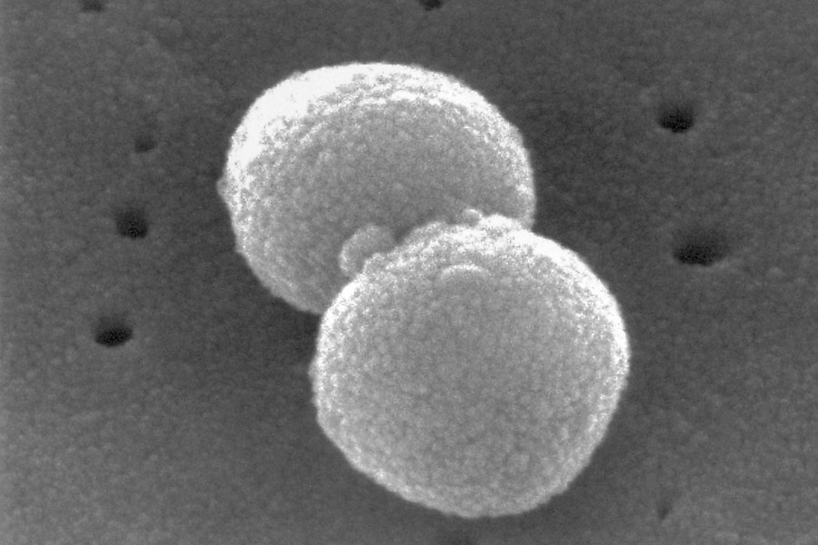 This electron microscopic image provided by the Centers for Disease Control and prevention depicts two, round-shaped, Gram-positive, Streptococcus pneumoniae bacteria. (Janice Haney Carr/CDC via AP)