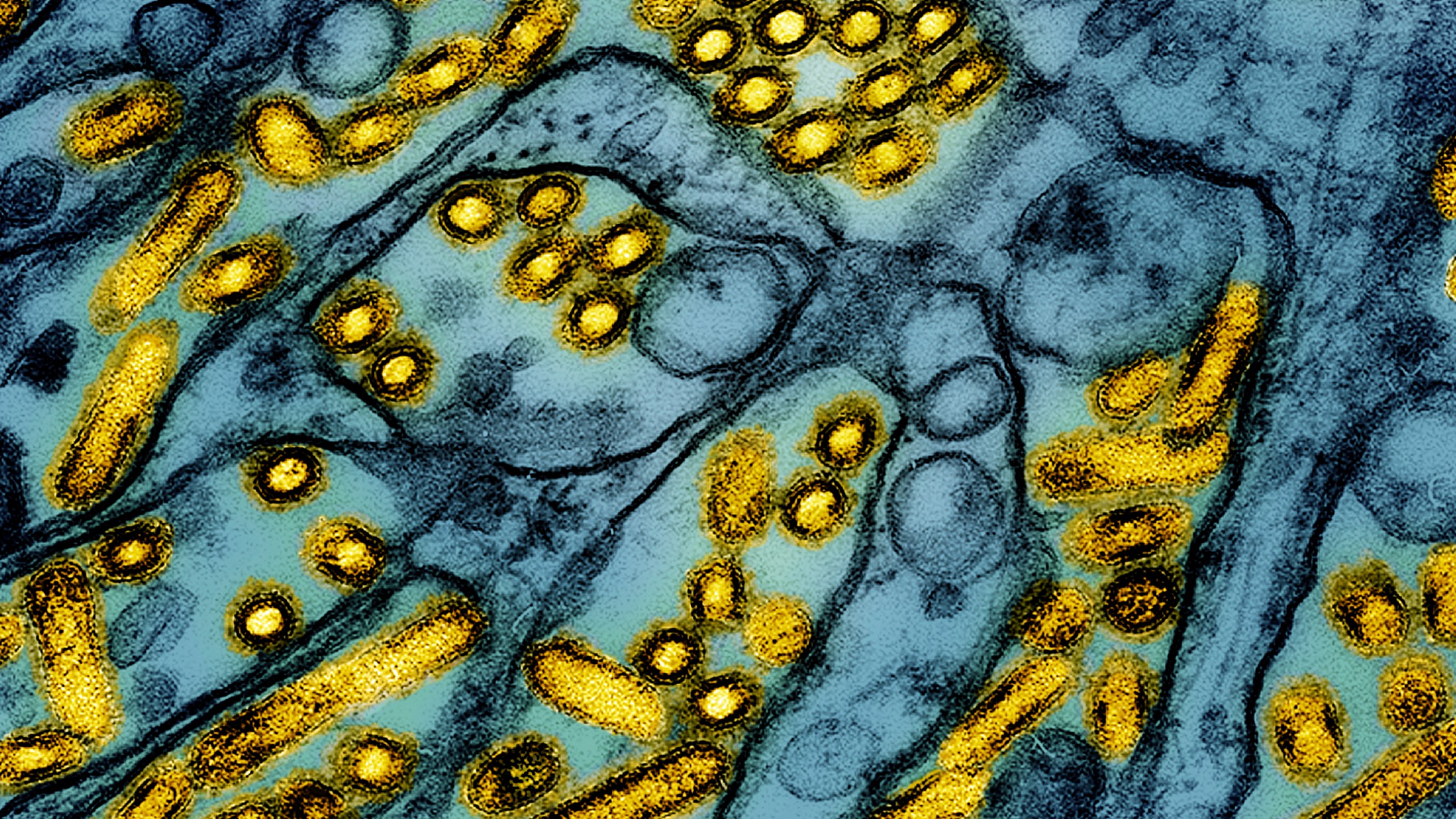 This colorized electron microscope image released by the National Institute of Allergy and Infectious Diseases on March 26, 2024, shows avian influenza A H5N1 virus particles (yellow), grown in Madin-Darby Canine Kidney (MDCK) epithelial cells (blue). (CDC/NIAID via AP)