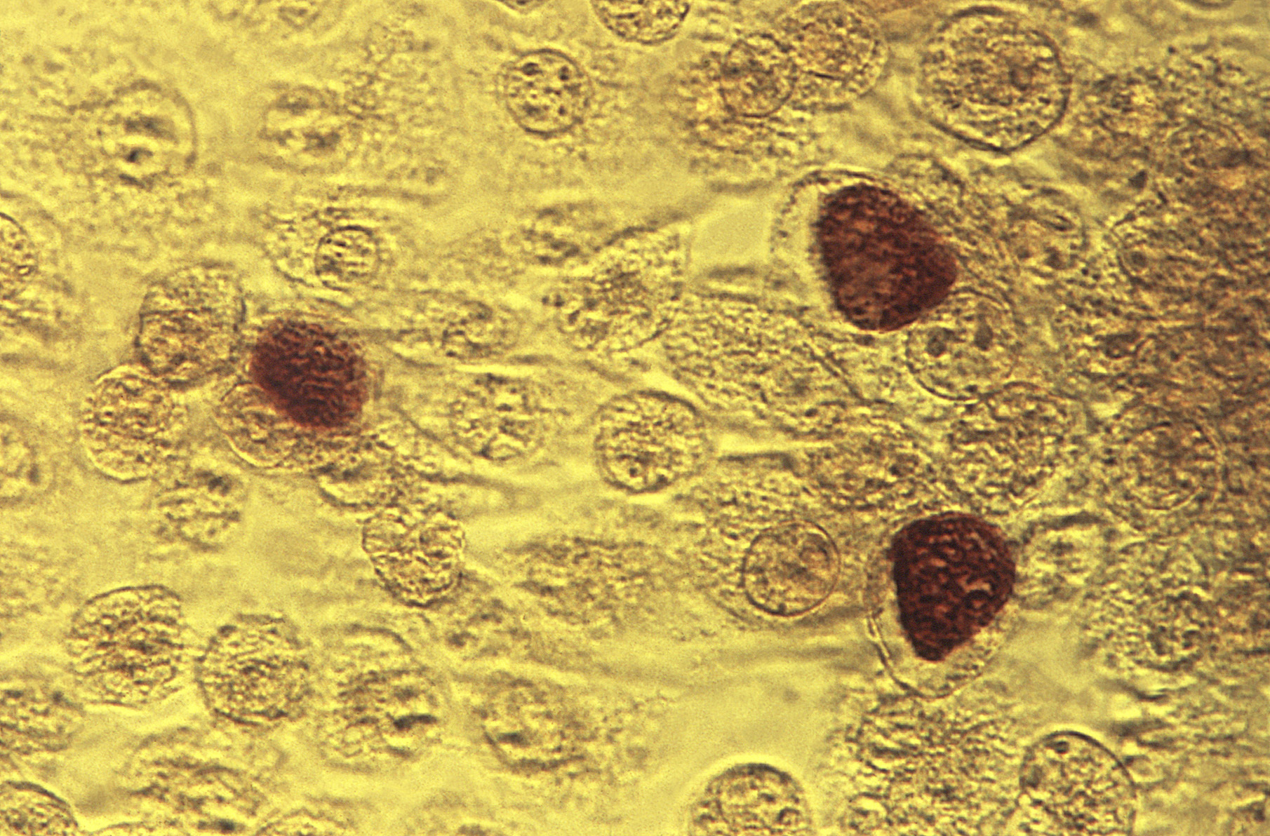 FILE - This 1975 microscope image made available by the the Centers for Disease Control and Prevention shows Chlamydia trachomatis bacteria. (Dr. E. Arum, Dr. N. Jacobs/CDC via AP)