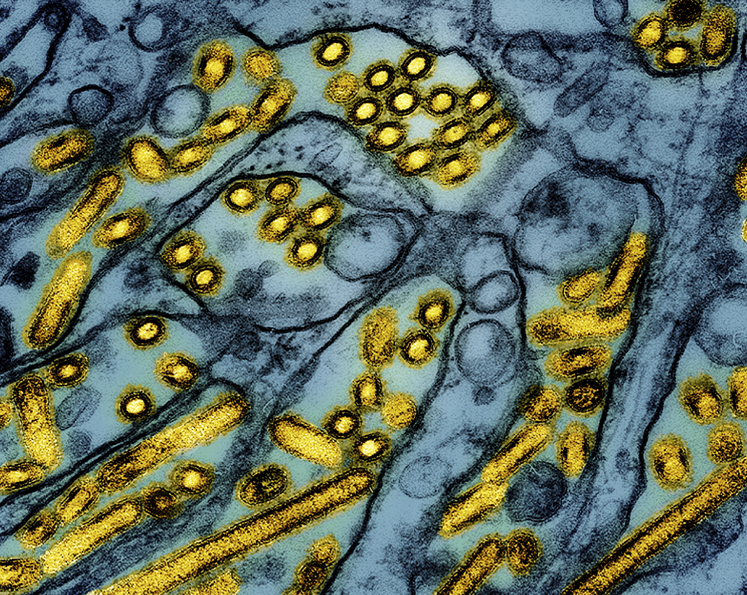 This colorized electron microscope image released by the National Institute of Allergy and Infectious Diseases on March 26, 2024, shows avian influenza A H5N1 virus particles (yellow), grown in Madin-Darby Canine Kidney (MDCK) epithelial cells (blue). (CDC/NIAID via AP)